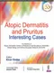Atopic Dermatitis and Pruritus Interesting Cases