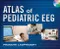 Atlas of Pediatric EEG With DVD
