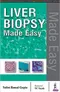 *Liver Biopsy Made Easy