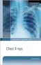 Pocket Guide to Chest X-rays