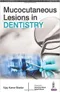 Mucocutaneous Lesions in Dentistry