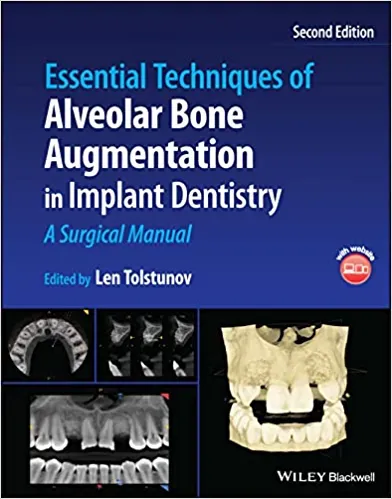 Essential Techniques Of Alveolar Bone Augmentation In Implant Dentistry A Surgical Manual