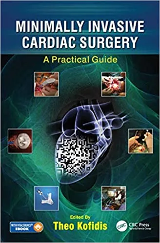 *Minimally Invasive Cardiac Surgery: A Practical Guide