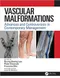 Vascular Malformations: Advances and Controversies in Contemporary Management