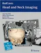 RadCases Head and Neck Imaging