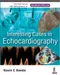 Interesting Cases in Echocardiography (Includes DVD-ROM)
