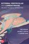External Ventricular and Lumbar Drains: Indications,Procedures,and Patient Care