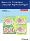 Nasoseptal Perforations: Endoscopic Repair Techniques