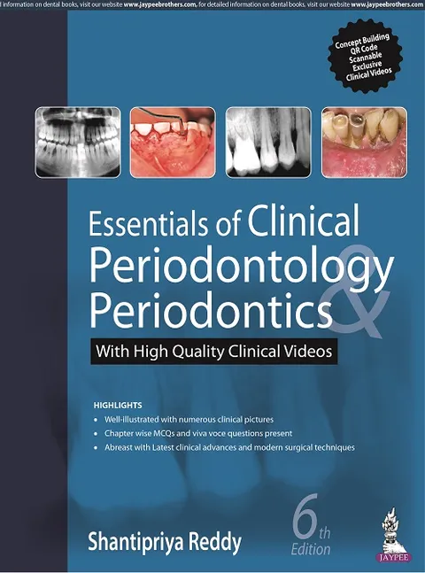 Essentials Of Clinical Periodontology And Periodontics