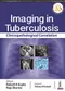 Imaging in Tuberculosis: Clinicopathological Correlation
