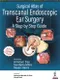 Surgical Atlas of Transcanal Endoscopic Ear Surgery: A Step by Step Guide