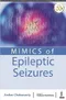 Mimics of Epileptic Seizures