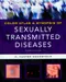 Color Atlas ＆ Synopsis of Sexually Transmitted Diseases (IE)