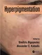*Hyperpigmentation