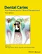 (舊版特價-恕不退換)Dental Caries: The Disease and Its Clinical Management