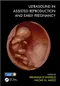 Ultrasound in Assisted Reproduction and Early Pregnancy