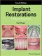 Implant Restorations: A Step-by-Step Guide