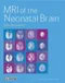 MRI of the Neonatal Brain