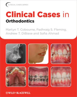 5 Class II Division 2 Malocclusion