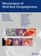 ＊Microsurgery of Skull Base Paragangliomas