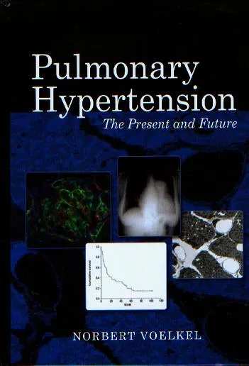 Pulmonary Hypertension: The Present & Future, 1st Edition