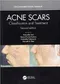 *Acne Scars: Classification and Treatment