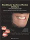 Mandibular Suction-Effective Denture