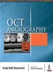OCT Angiography