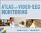 Atlas of Video-EEG Monitoring with CD-ROM
