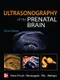 (舊版特價-恕不退換)Ultrasonography of the Prenatal Brain