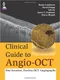*Clinical Guide to Angio-OCT (Non Invasive, Dyeless OCT Angiography)