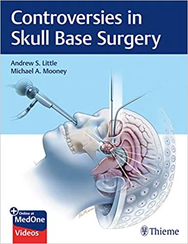 Handbook of Skull Base Surgery eBook : Di Ieva, Antonio, Lee