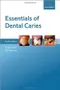 Essentials of Dental Caries