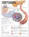 Understanding Type 1 Diabetes Anatomical Chart Paper Unmounted