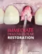Immediate Dentoalveolar Restoration: Immediately Loaded Implants in Compromised Sockets