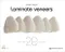 Laminate Veneers