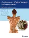 Controversies in Spine Surgery, MIS versus OPEN: Best Evidence Recommendations