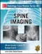 Radiology Case Review Series: Spine Imaging