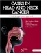 *Cases in Head and Neck Cancer: A Multidisciplinary Approach