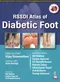 RSSDI Atlas of Diabetic Foot