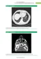 Mayo Clinic Case Review for Pulmonary and Critical Care Boards (內附序號不可拆封)