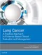 Lung Cancer: A Practical Approach to Evidence-Based Clinical Evaluation and Management