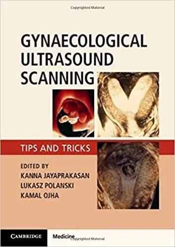 *Gynaecological Ultrasound Scanning: Tips and Tricks