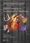 Hybrid Imaging in Cardiovascular Medicine