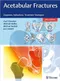 Acetabular Fractures: Diagnosis, Indications, Treatment Strategies
