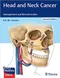 Head and Neck Cancer: Management and Reconstruction