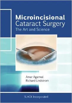Microincisional Cataract Surgery: The Art and Science