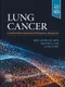 Lung Cancer: An Evidence-Based Approach to Multidisciplinary Management