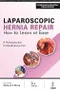 Laparoscopic Hernia Repair: How to Learn at Ease