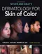 Taylor and Kelly's Dermatology for Skin of Color